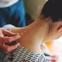 Scott Martin Acupuncture - Seniors Australia 0