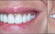 Active Denture Clinic - thumb 0