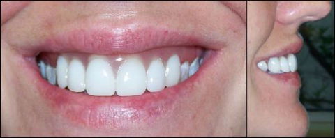 Active Denture Clinic - Seniors Australia 0