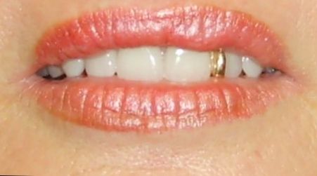 Active Denture Clinic - Seniors Australia 2