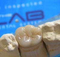The Lab Dental Systems - Seniors Australia
